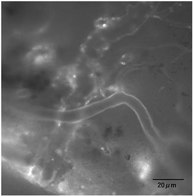 Vascular Endothelial Glycocalyx Plays a Role in the Obesity Paradox According to Intravital Observation